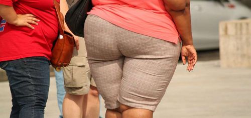 Obesità della persona causata da un eccesso di sovrappeso