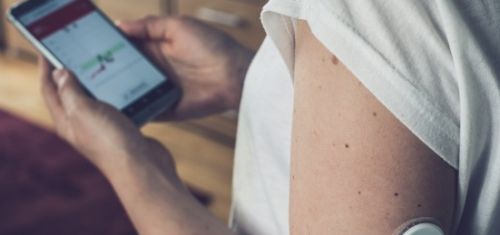 diabete e sensore glicemico