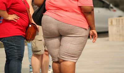 Obesità della persona causata da un eccesso di sovrappeso
